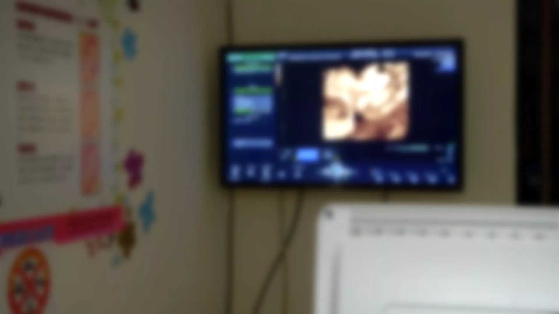 Tình trạng bạo hành trẻ nghiêm trọng, bé gái 6 tháng tuổi tổn thương não