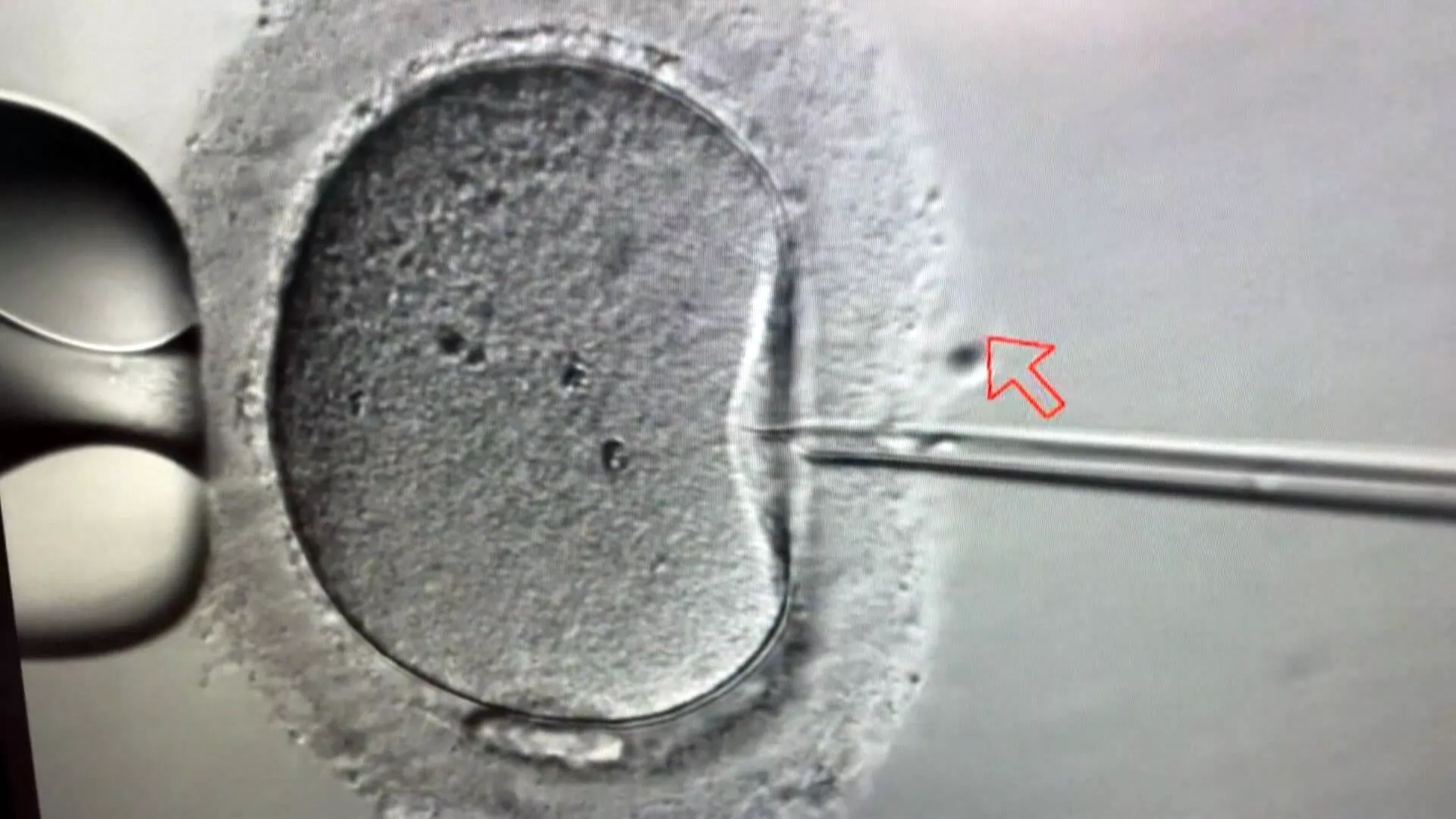 Revisi UU Reproduksi Buatan diloloskan bagi pasangan wanita sesama jenis