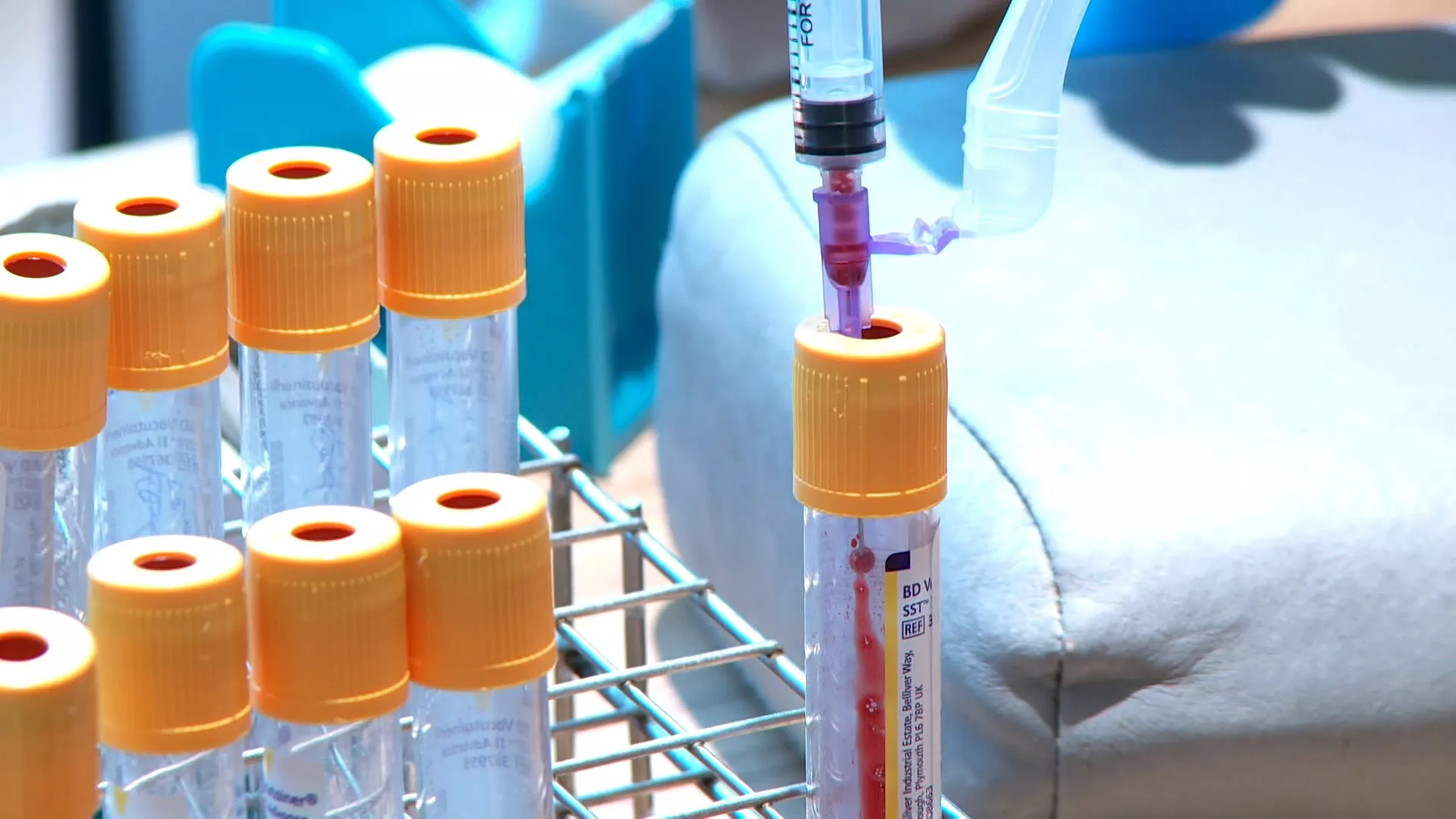 Jumlah kasus hepatitis A Taiwan tahun lalu capai 447 orang, tertinggi dalam 9 tahun