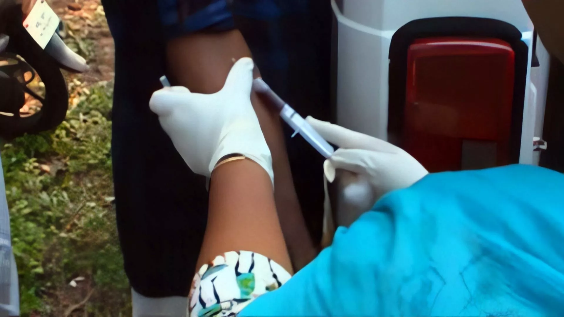 Báo động virus Nipah từ dơi ăn quả, tỷ lệ tử vong lên đến 58%