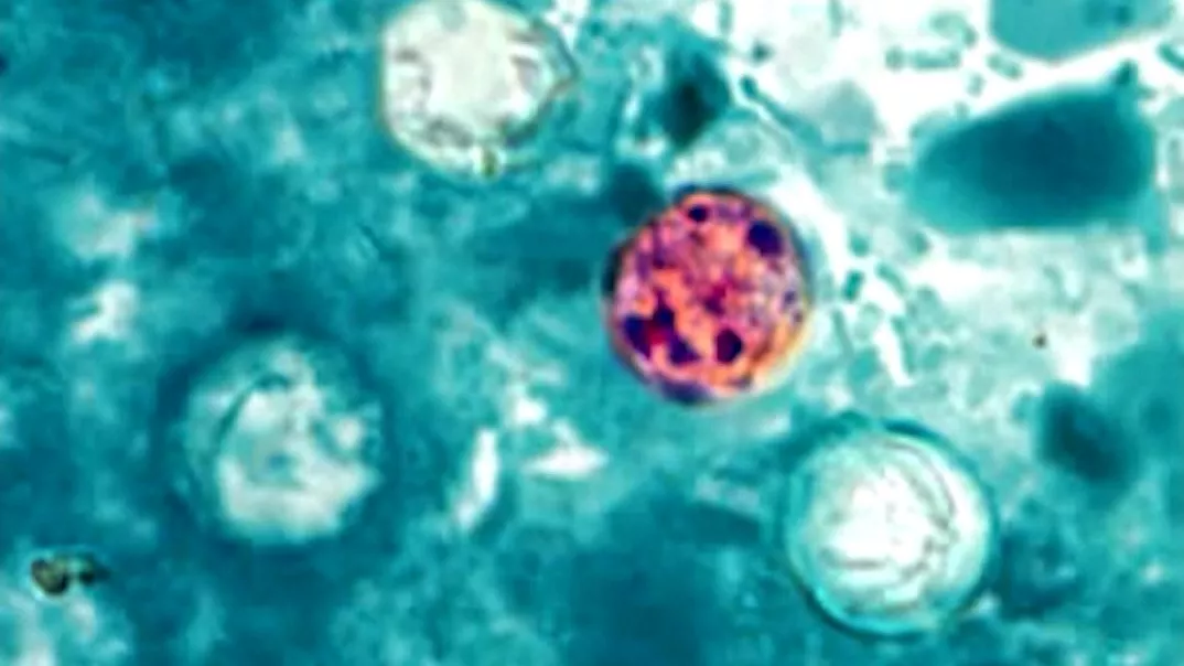 Wabah siklosporiasis di AS melonjak, Michigan laporkan 2 kasus kematian pertama