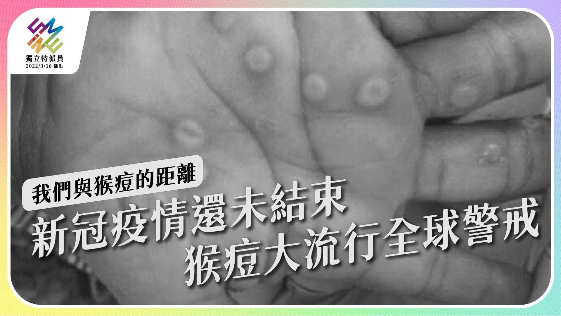 8/17 週三晚間十點 《我們與猴痘的距離》